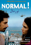 Normal/1dvd